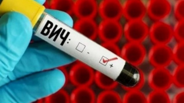 В Назарово возросла заболеваемость ВИЧ