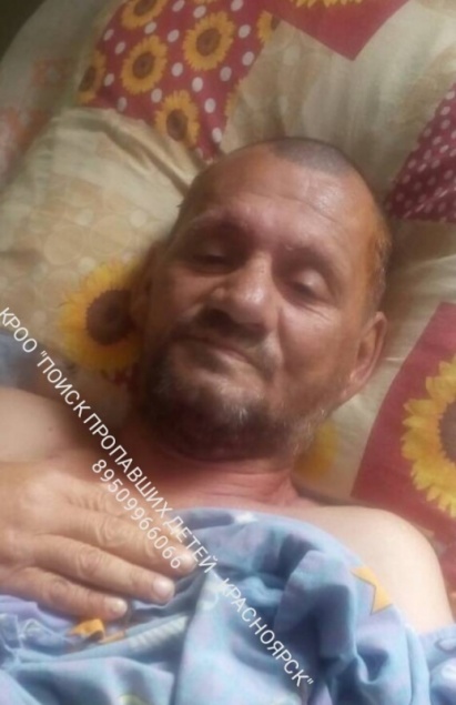 Пациент после операции пропал из больницы в Назарово