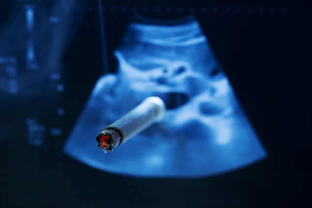 Курение вредит эмбрионам на клеточном уровне