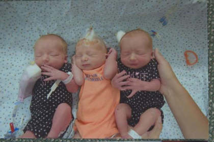 Женщина узнала о беременности во время схваток и родила тройню