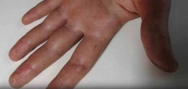 «Поставил велосипед и закричал»: ребёнка на улице ударило током