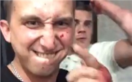 Подозреваемых в жестоком избиении спортсмена следователи требуют взять под стражу