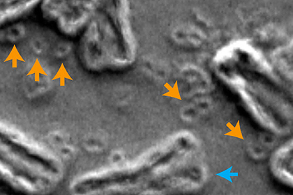 Раскрыта причина непобедимости рака