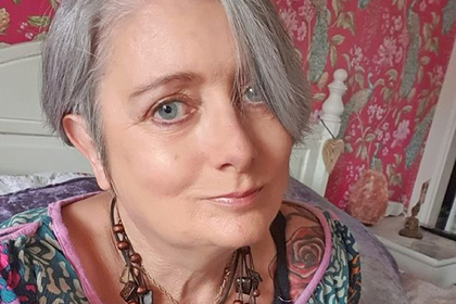 Женщина решилась на липосакцию и осталась с «обглоданными» ногами