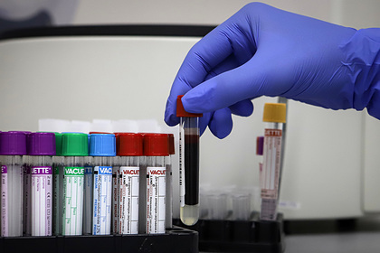 В России впервые с 1 мая выявили меньше 8 тысяч заразившихся коронавирусом