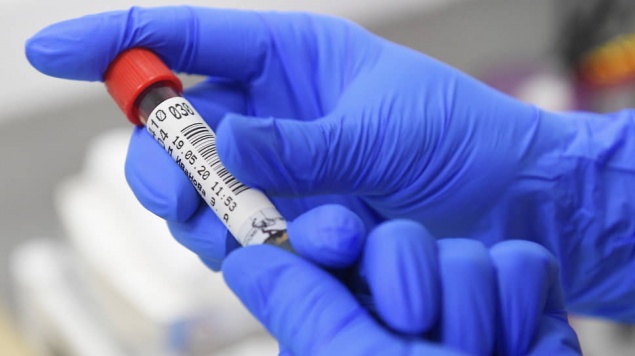 В Красноярском крае еще 112 случаев заболевания коронавирусом. Семеро погибли