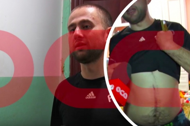 «Ничего хорошего нет, детей забрали»: отец избитого ребенка-инвалида расплакался перед телекамерой