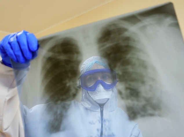 В Красноярском крае еще 18 человек умерли от коронавируса