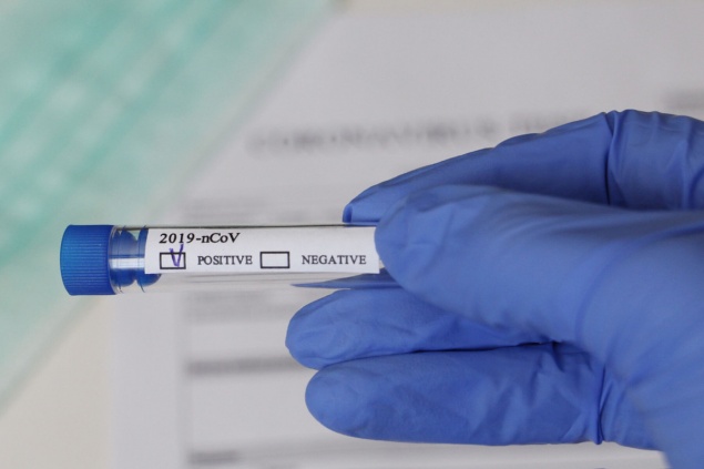 Иммунолог объяснил россиянам разницу между экспресс- и ПЦР-тестами