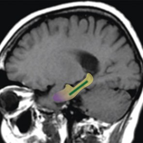 Какао оказалось мощным средством против старческого слабоумия