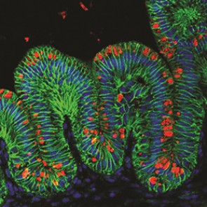 Ученые впервые вырастили искусственные желудки
