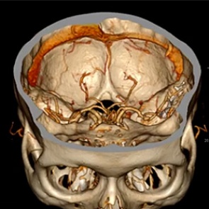 Обнаружена главная опасность курения