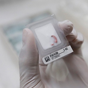 Найдена причина неизлечимости рака