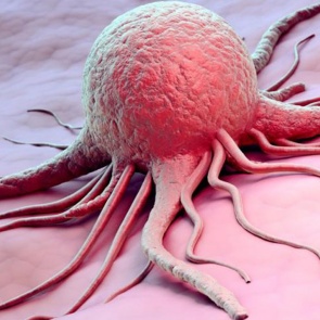 Раскрыта причина появления особо смертоносного рака