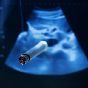 Курение вредит эмбрионам на клеточном уровне