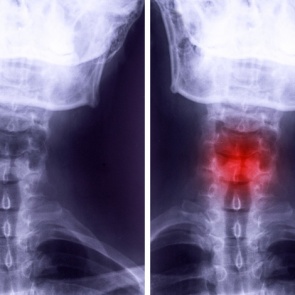 Простой прием, который поможет говорить на публике без предательски дрожащего голоса