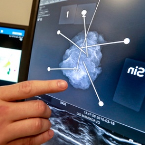 России предсказали резкий рост смертности от онкологии