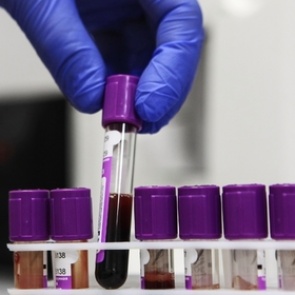 Найдена причина смертельного рака крови