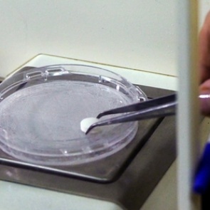 Обнаружена польза употребления аспирина раз в неделю