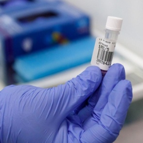 Еще 11 новых больных коронавирусом выявили в Хакасии. В Туве прирост идет медленнее