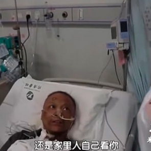 Пациенты с коронавирусом потемнели из-за побочных эффектов лечения