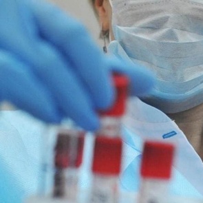 Число заболевших COVID-19 в Хакасии достигло 99 человек