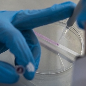 Российские ученые разработали тест для диагностики рака по выдыхаемому воздуху