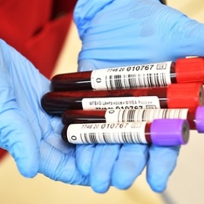 Стало известно о результатах лечения коронавируса антителами в России