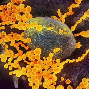 Описаны отличия попавшего в Россию штамма коронавируса