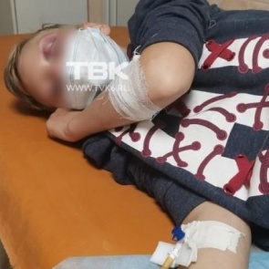 На правом берегу неизвестный сильно избил 10-летнего мальчика