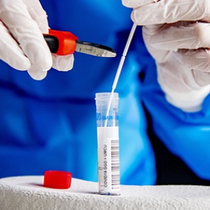 Профессор пожаловался на странные симптомы после выздоровления от коронавируса