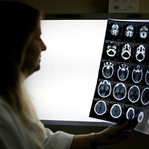 Биолог описала способность коронавируса поражать мозг