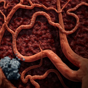 Решена столетняя загадка раковых опухолей