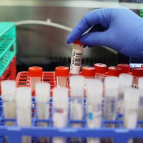 Ученый представил «вероятную на 99,9 процента» версию появления коронавируса