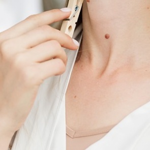 Дерматолог назвала категории россиян с высоким риском рака кожи