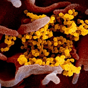 Эпидемия коронавируса поразила человечество более 20 тысяч лет назад