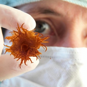 В Красноярском крае выросло количество больных раком