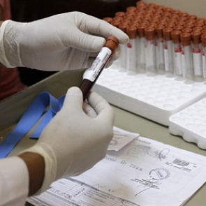 Назван необычный симптом рака крови