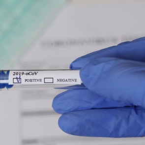 Иммунолог объяснил россиянам разницу между экспресс- и ПЦР-тестами