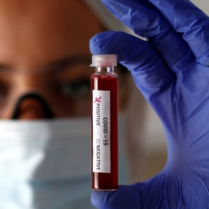 Россиян предупредили о повышенных рисках заболеть COVID-19 после омикрон-штамма