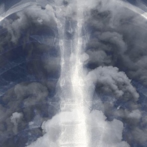 Врач рассказал о восстановлении легких бывших курильщиков